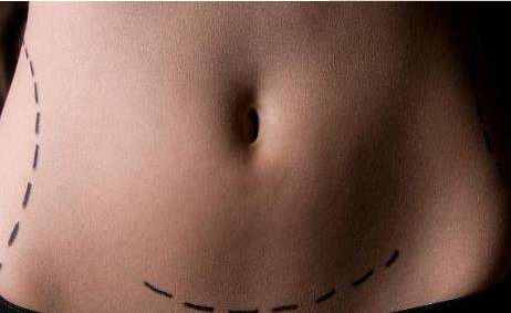 正常阴道分泌物的异常分泌物有哪些类型？