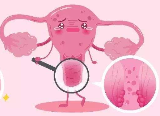 白带常规香蕉视频免费APP厂家提醒女士做好私密处清洗