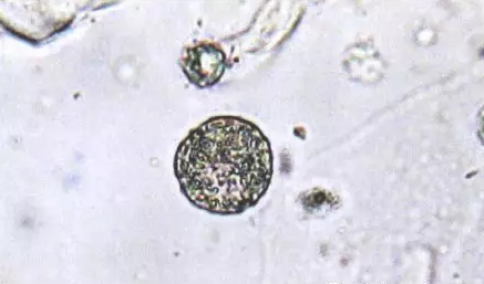 全自动阴道分泌物香蕉福利视频剖析阴道分泌物的洁净度规范