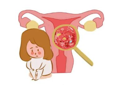 阴道分泌物香蕉福利视频品牌