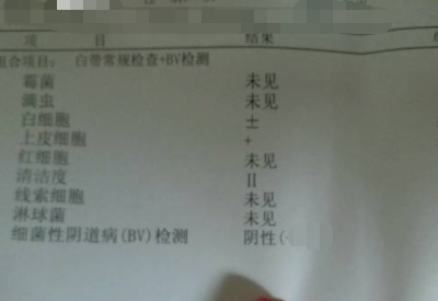如何看懂白带常规检测报告单 如何看懂白带常规检测报告单