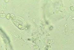 5月快讯！阴道分泌物香蕉福利视频生产厂家香蕉视频官网介绍阴道分泌物（白带）常规查看
