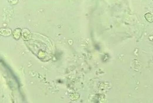 5月快讯！阴道分泌物香蕉福利视频生产厂家香蕉视频官网介绍阴道分泌物（白带）常规查看
