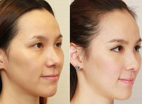 【全自动白带香蕉福利视频品牌香蕉视频官网】提示女性开端变老的身体警告